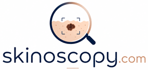 Skinoscopy — See more. Diagnose better.